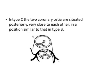 • Intype C the two coronary ostia are situated
  posteriorly, very close to each other, in a
  position similar to that in type B.
 