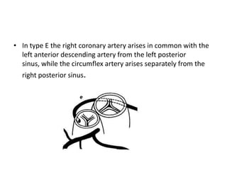 • In type E the right coronary artery arises in common with the
  left anterior descending artery from the left posterior
  sinus, while the circumflex artery arises separately from the
  right posterior sinus.
 