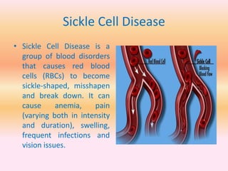 Sickle Cell Disease
• Sickle Cell Disease is a
group of blood disorders
that causes red blood
cells (RBCs) to become
sickle-shaped, misshapen
and break down. It can
cause anemia, pain
(varying both in intensity
and duration), swelling,
frequent infections and
vision issues.
 