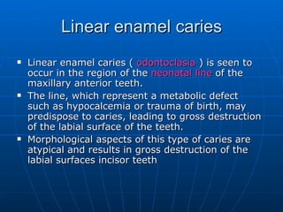 Linear enamel caries (  odontoclasia  ) is seen to occur in the region of the  neonatal line  of the maxillary anterior teeth.  The line, which represent a metabolic defect such as hypocalcemia or trauma of birth, may predispose to caries, leading to gross destruction of the labial surface of the teeth. Morphological aspects of this type of caries are atypical and results in gross destruction of the labial surfaces incisor teeth Linear enamel caries 