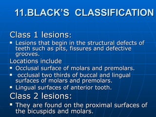 11.BLACK’S  CLASSIFICATION Class 1 lesions : Lesions that begin in the structural defects of teeth such as pits, fissures and defective grooves. Locations include Occlusal surface of molars and premolars. occlusal two thirds of buccal and lingual surfaces of molars and premolars.  Lingual surfaces of anterior tooth. Class 2 lesions: They   are found on the proximal surfaces of the bicuspids and molars. 