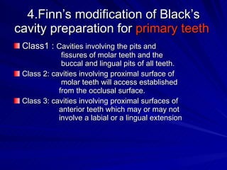 4.Finn’s modification of Black’s cavity preparation for  primary teeth   Class1 :  Cavities involving the pits and   fissures of molar teeth and the     buccal and lingual pits of all teeth. Class 2: cavities involving proximal surface of   molar teeth will access established    from the occlusal surface. Class 3: cavities involving proximal surfaces of  anterior teeth which may or may not  involve a labial or a lingual extension  