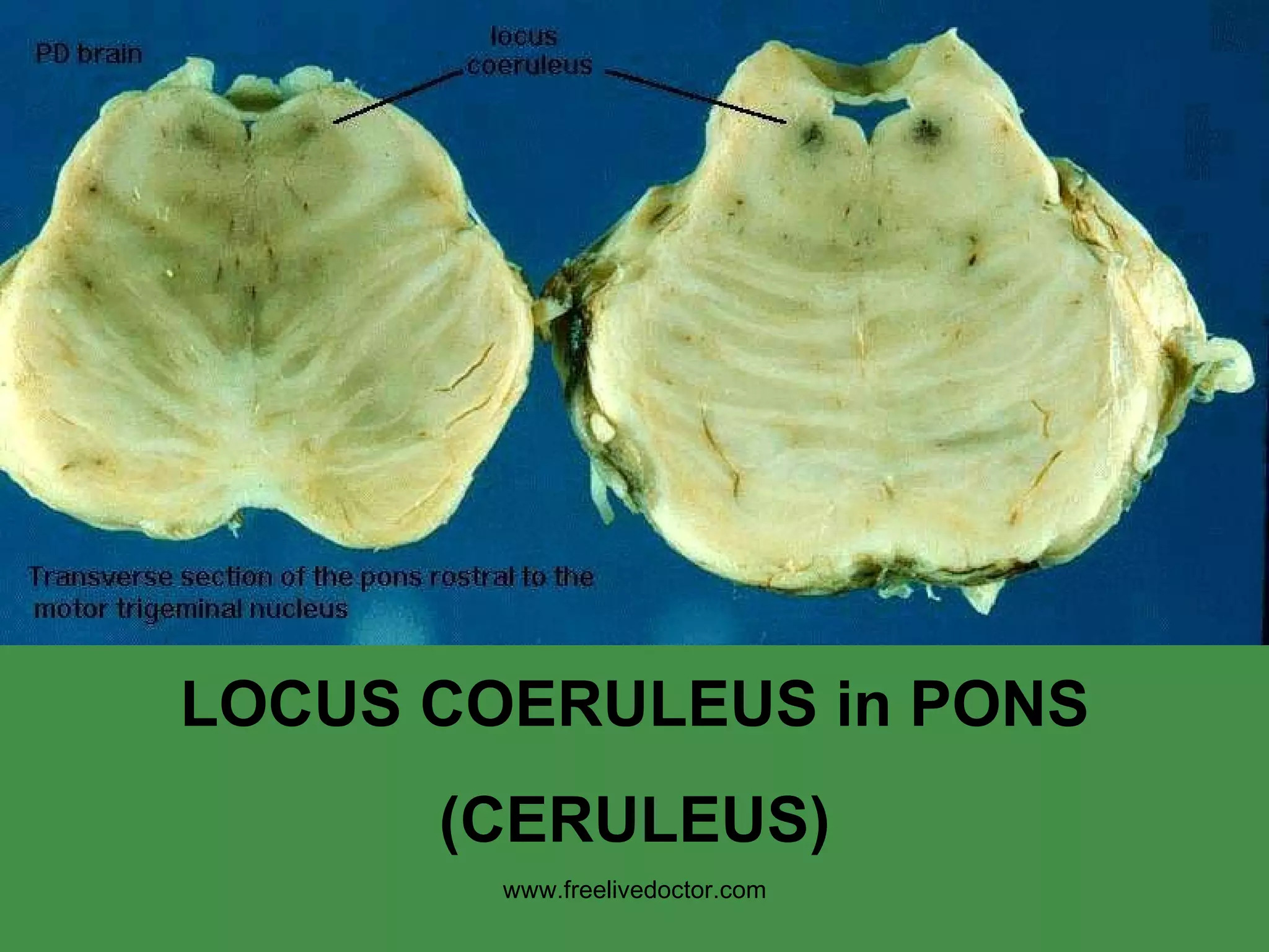LOCUS COERULEUS in PONS (CERULEUS) www.freelivedoctor.com 