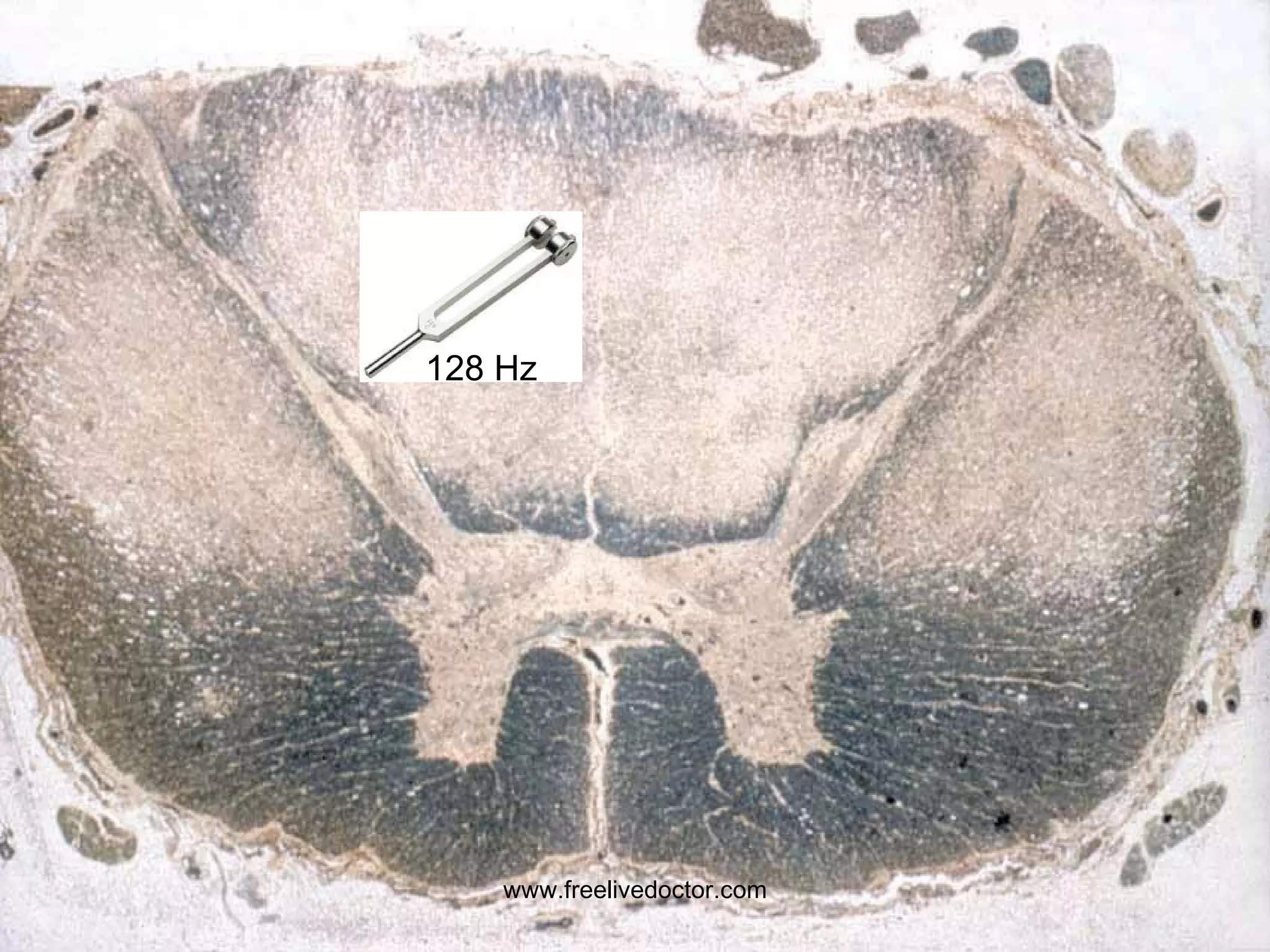 128 Hz www.freelivedoctor.com 