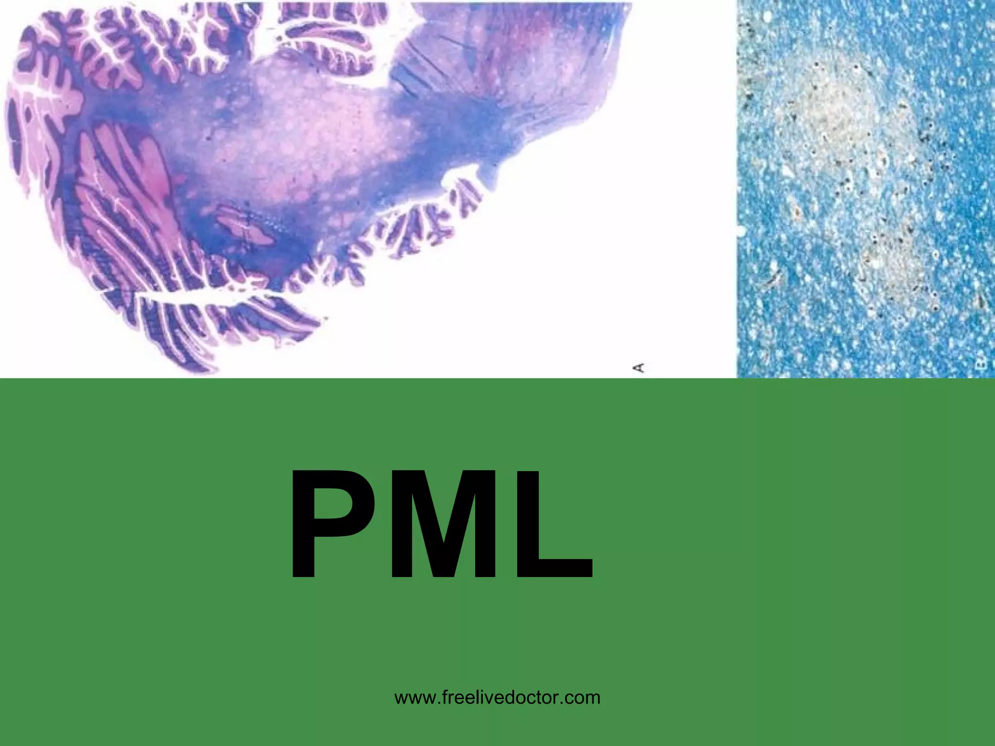 PML www.freelivedoctor.com 