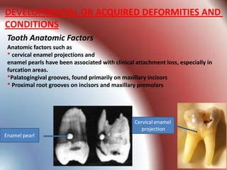 DEVELOPMENTAL OR ACQUIRED DEFORMITIES AND
CONDITIONS
 Tooth Anatomic Factors
 Anatomic factors such as
 * cervical enamel projections and
 enamel pearls have been associated with clinical attachment loss, especially in
 furcation areas.
 *Palatogingival grooves, found primarily on maxillary incisors
 * Proximal root grooves on incisors and maxillary premolars




                                                  Cervical enamel
                                                     projection
Enamel pearl
 