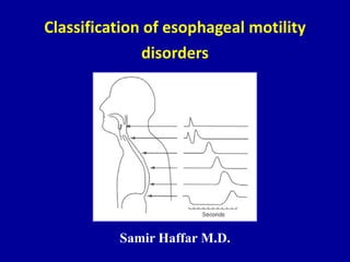 Classification of esophageal motility
disorders
Samir Haffar M.D.
 