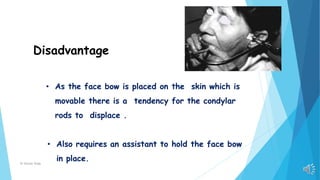 Condylar Rods Classification of facebow | PPTX