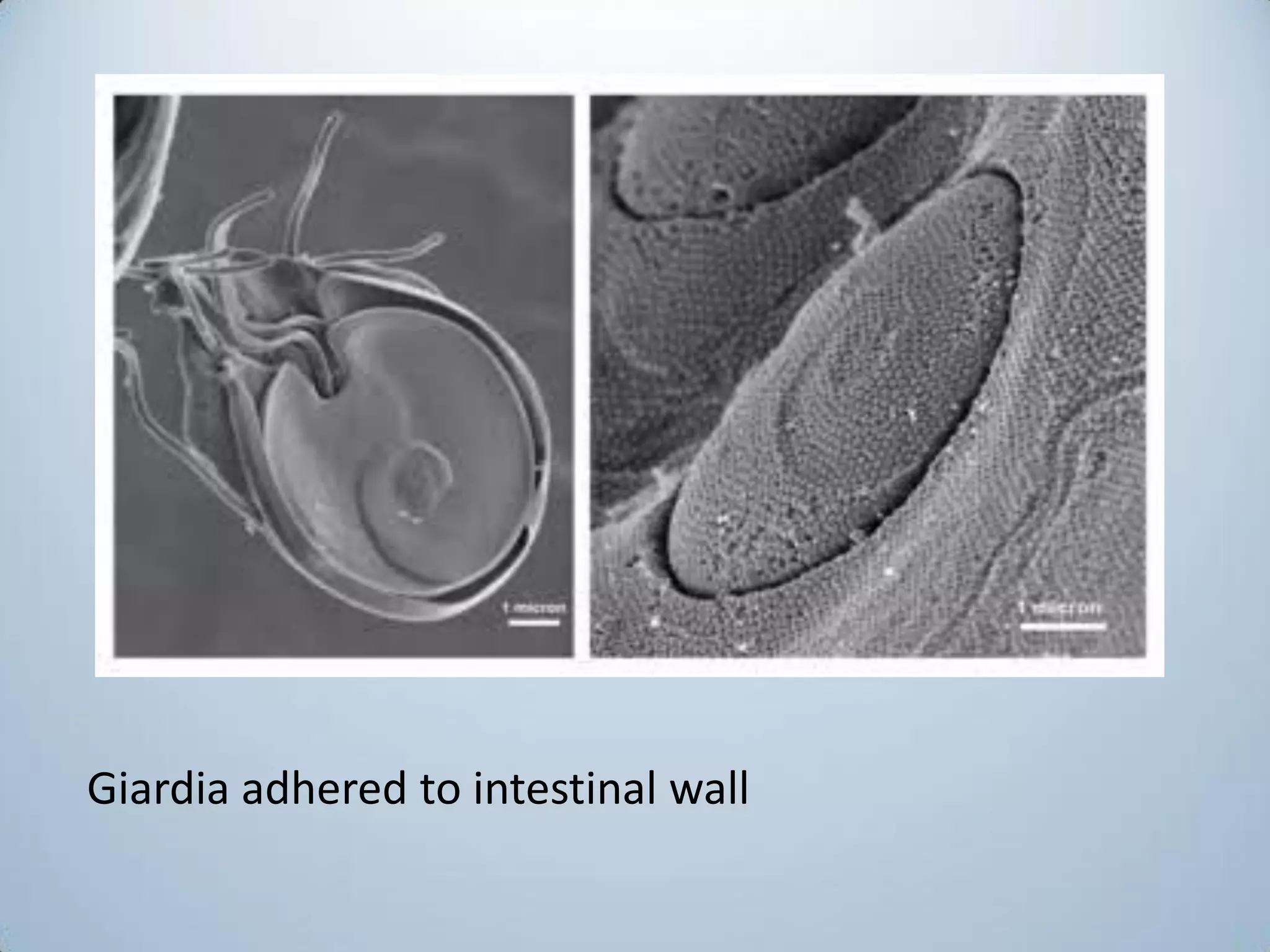 Classification of flagellates and giardia lamblia | PDF