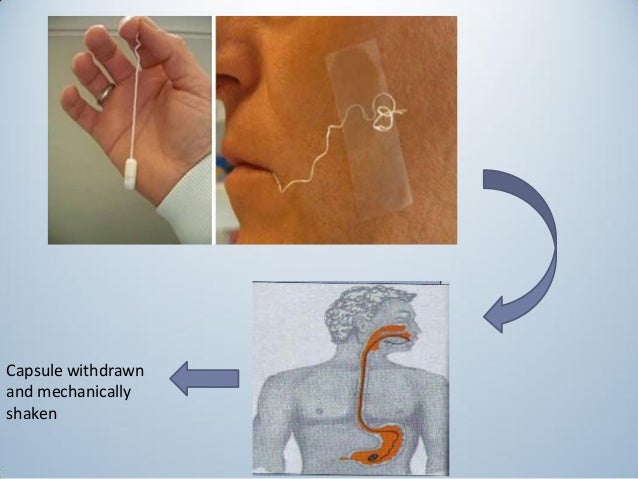 strip test i pregnancy can of flagellates and lamblia giardia Classification strip test i pregnancy can of flagellates and lamblia giardia Classification