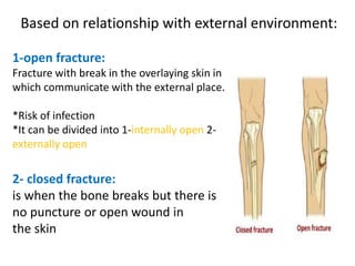 Based on relationship with external environment:
1-open fracture:
Fracture with break in the overlaying skin in
which communicate with the external place.
*Risk of infection
*It can be divided into 1-internally open 2-
externally open
2- closed fracture:
is when the bone breaks but there is
no puncture or open wound in
the skin
 
