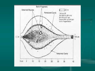 Classification of gunshot wounds | PPTX