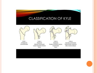 CLASSIFICATION OF IT-u2.pptx
