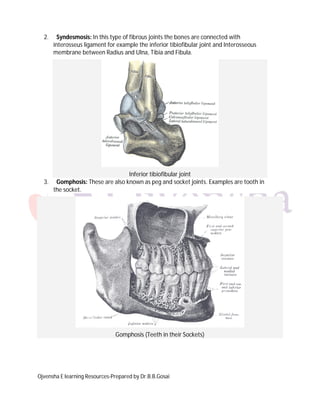 Ojvensha E learning Resources-Prepared by Dr.B.B.Gosai
2. Syndesmosis: In this type of fibrous joints the bones are connected with
interosseus ligament for example the inferior tibiofibular joint and Interosseous
membrane between Radius and Ulna, Tibia and Fibula.
Inferior tibiofibular joint
3. Gomphosis: These are also known as peg and socket joints. Examples are tooth in
the socket.
Gomphosis (Teeth in their Sockets)
 