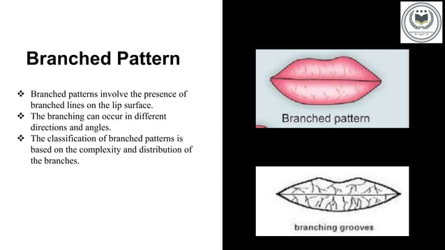 classification of lip prints | PPTX | Crime & Harmful Acts to ...