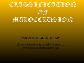 CLASSIFICATION
OF
MALOCCLUSION
INDIAN DENTAL ACADEMY
Leader in continuing dental education
www.indiandentalacademy.com
www.indiandentalacademy.com
 