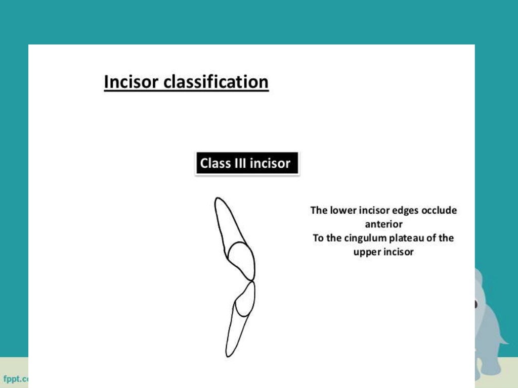 Classification of malocclusion in orthodontics