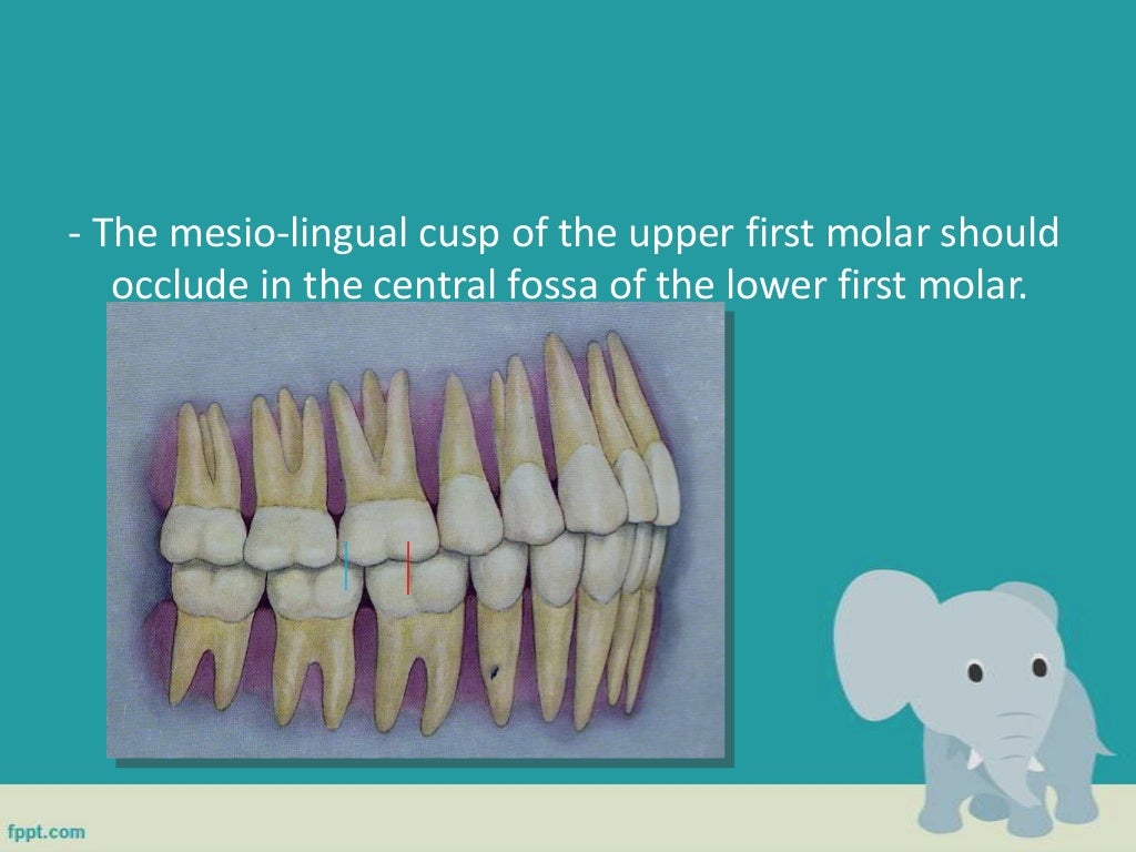 Classification of malocclusion in orthodontics