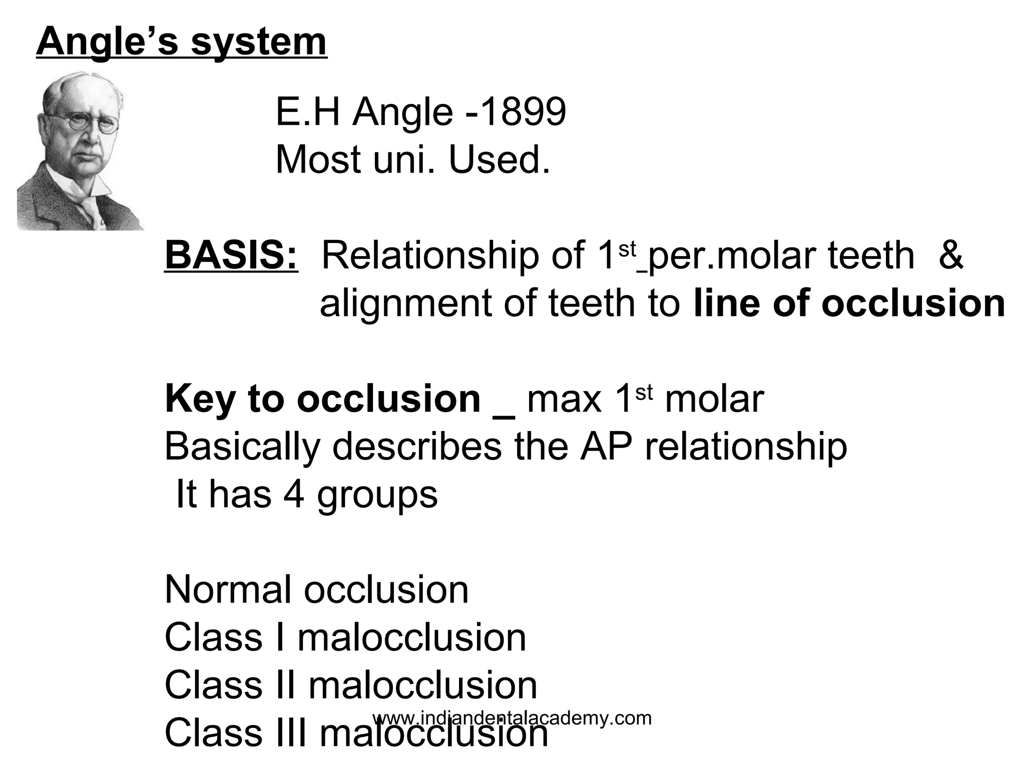 Angle’s system
E.H Angle -1899
Most uni. Used.
BASIS: Relationship of 1st per.molar teeth &
alignment of teeth to line of occlusion
Key to occlusion _ max 1st molar
Basically describes the AP relationship
It has 4 groups
Normal occlusion
Class I malocclusion
Class II malocclusion
www.indiandentalacademy.com
Class III malocclusion

 