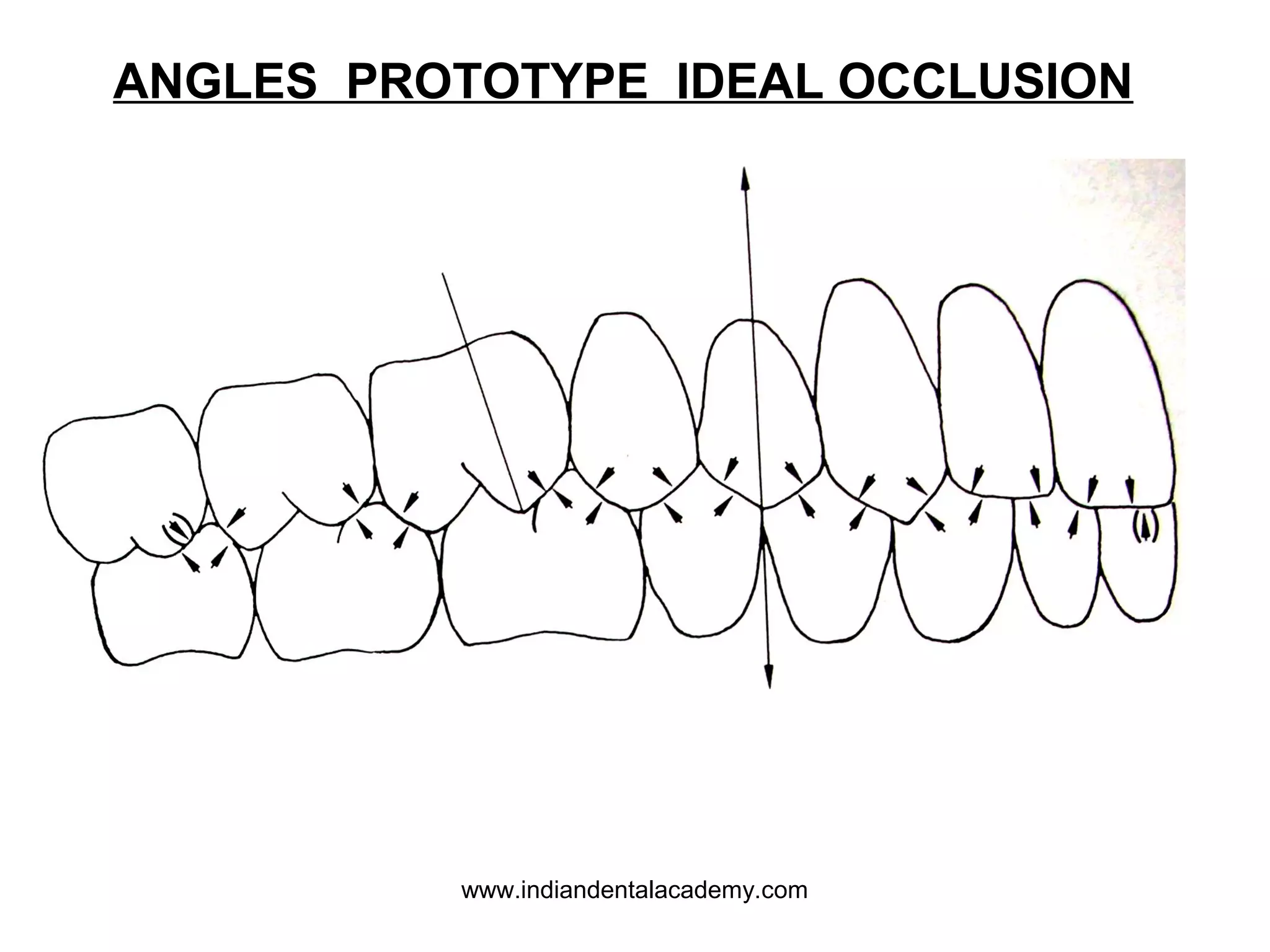 ANGLES PROTOTYPE IDEAL OCCLUSION

www.indiandentalacademy.com

 