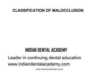 CLASSIFICATION OF MALOCCLUSION

INDIAN DENTAL ACADEMY
Leader in continuing dental education
www.indiandentalacademy.com
www.indiandentalacademy.com

 