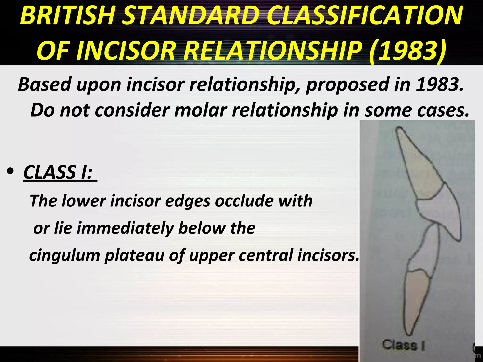 BRITISH STANDARD CLASSIFICATION
OF INCISOR RELATIONSHIP (1983)
Based upon incisor relationship, proposed in 1983.
Do not consider molar relationship in some cases.
• CLASS I:
The lower incisor edges occlude with
or lie immediately below the
cingulum plateau of upper central incisors.

 