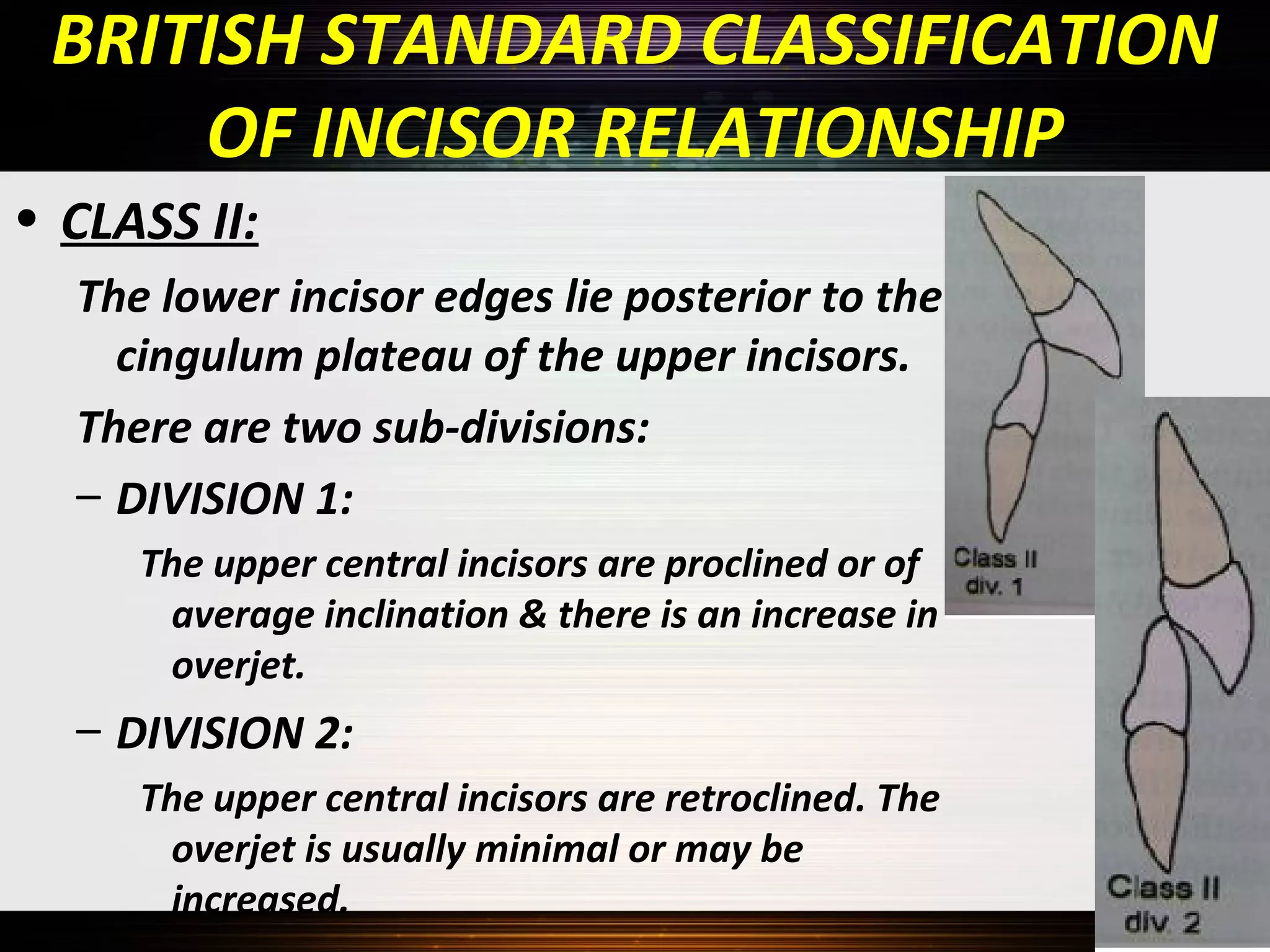 BRITISH STANDARD CLASSIFICATION
OF INCISOR RELATIONSHIP
• CLASS II:
The lower incisor edges lie posterior to the
cingulum plateau of the upper incisors.
There are two sub-divisions:
– DIVISION 1:
The upper central incisors are proclined or of
average inclination & there is an increase in
overjet.

– DIVISION 2:
The upper central incisors are retroclined. The
overjet is usually minimal or may be
increased.

 