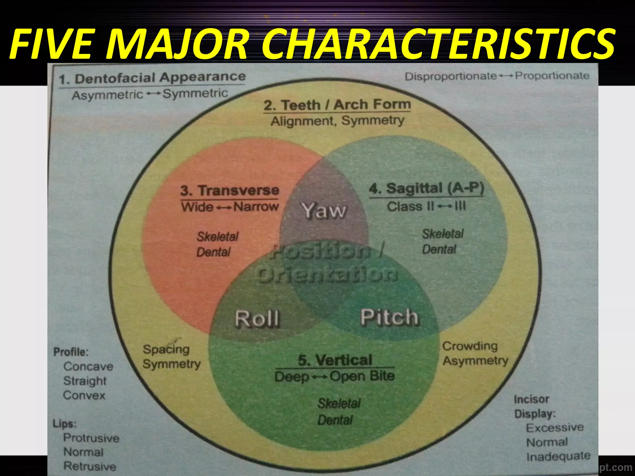 FIVE MAJOR CHARACTERISTICS

 
