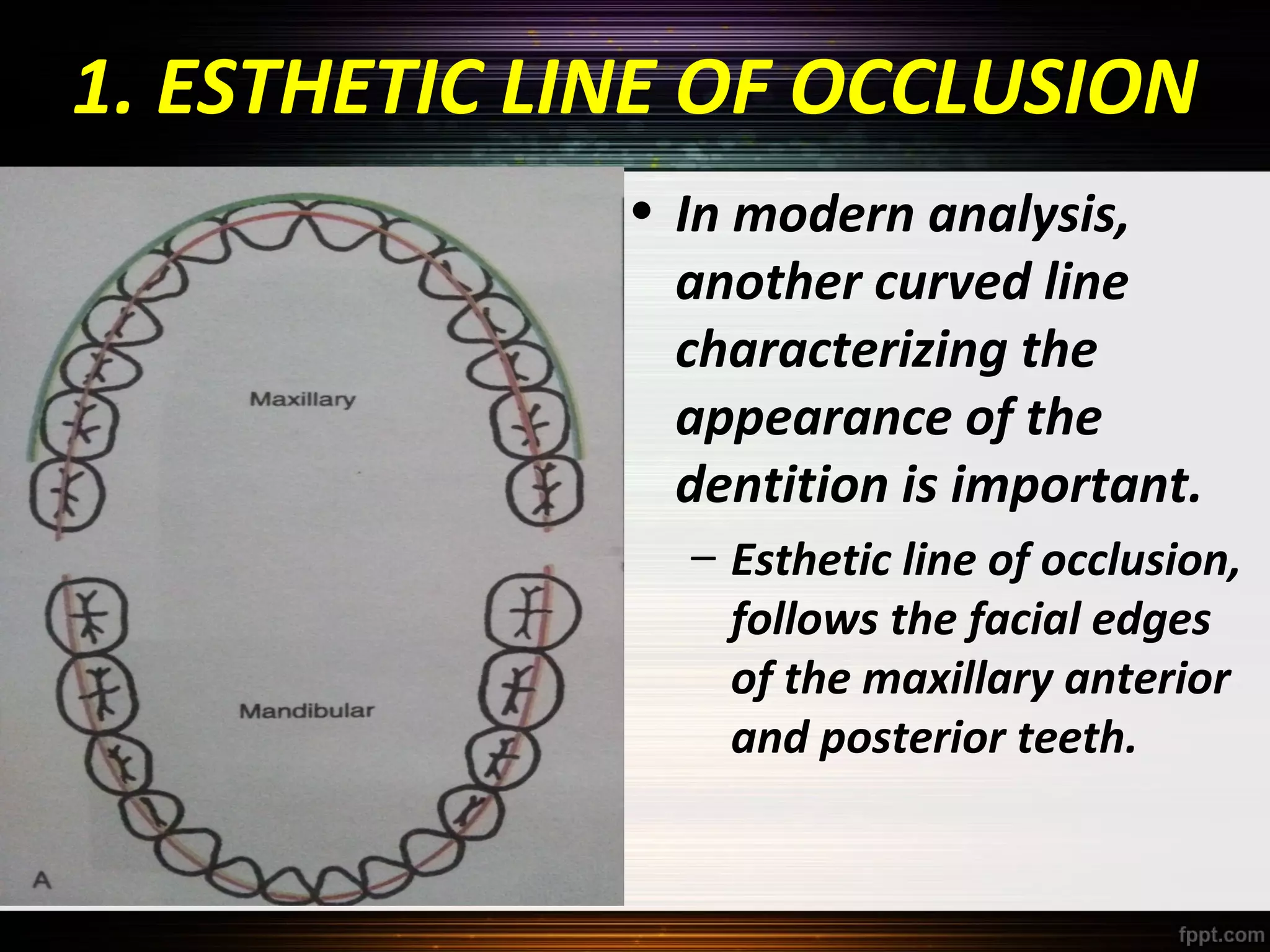 1. ESTHETIC LINE OF OCCLUSION
• In modern analysis,
another curved line
characterizing the
appearance of the
dentition is important.
– Esthetic line of occlusion,
follows the facial edges
of the maxillary anterior
and posterior teeth.

 