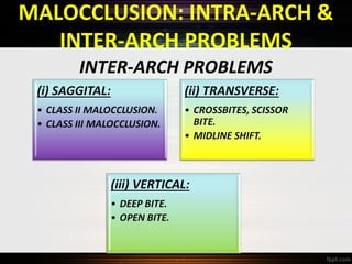MALOCCLUSION: INTRA-ARCH &
INTER-ARCH PROBLEMS
INTER-ARCH PROBLEMS

 