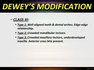 DEWEY’S MODIFICATION
– CLASS III:
• Type 1: Well aligned teeth & dental arches. Edge-edge
relationship.
• Type 2: Crowded mandibular incisors.
• Type 3: Crowded maxillary incisors, underdeveloped
maxilla. Anterior cross bite present.

 
