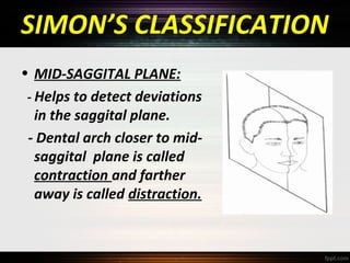SIMON’S CLASSIFICATION
• MID-SAGGITAL PLANE:
- Helps to detect deviations
in the saggital plane.
- Dental arch closer to midsaggital plane is called
contraction and farther
away is called distraction.

 