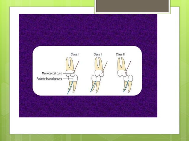 Classification of malocclusion | PPT