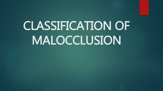 CLASSIFICATION OF
MALOCCLUSION
 