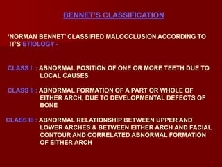 Classification of malocclusion | PPT