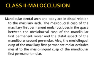 Mandibular dental arch and body are in distal relation
to the maxillary arch. The mesiobuccal cusp of the
maxillary first permanent molar occludes in the space
between the mesiobuccal cusp of the mandibular
first permanent molar and the distal aspect of the
mandibular second pre-molar. Also, the mesiolingual
cusp of the maxillary first permanent molar occludes
mesial to the mesio-linguaI cusp of the mandibular
first permanent molar.
 