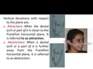 Vertical deviations with respect
to the plane are:
1. Attractions When the dental
arch or part of it is closer to the
Frankfort horizontal plane. It
is referred to as attraction.
2. Abstractions When a dental
arch or a part of it is further
away from the Frankfort
horizontal plane, it is referred
to as abstraction.
 