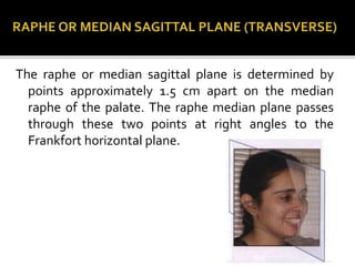 The raphe or median sagittal plane is determined by
points approximately 1.5 cm apart on the median
raphe of the palate. The raphe median plane passes
through these two points at right angles to the
Frankfort horizontal plane.
 