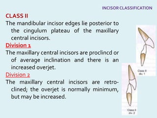 CLASS II
The mandibular incisor edges lie posterior to
the cingulum plateau of the maxillary
central incisors.
Division 1
The maxillary central incisors are proclincd or
of average inclination and there is an
increased overjet.
Division 2
The maxillary central incisors are retro-
clined; the overjet is normally minimum,
but may be increased.
 