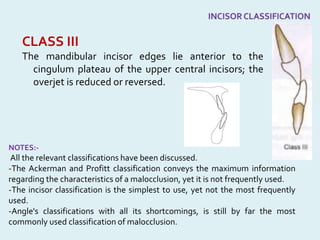CLASS III
The mandibular incisor edges lie anterior to the
cingulum plateau of the upper central incisors; the
overjet is reduced or reversed.
NOTES:-
All the relevant classifications have been discussed.
-The Ackerman and Profitt classification conveys the maximum information
regarding the characteristics of a malocclusion, yet it is not frequently used.
-The incisor classification is the simplest to use, yet not the most frequently
used.
-Angle's classifications with all its shortcomings, is still by far the most
commonly used classification of malocclusion.
 