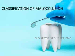 CLASSIFICATION OF MALOCCLUSION
GLO ARBY D. ARGUELLES, DMD
 