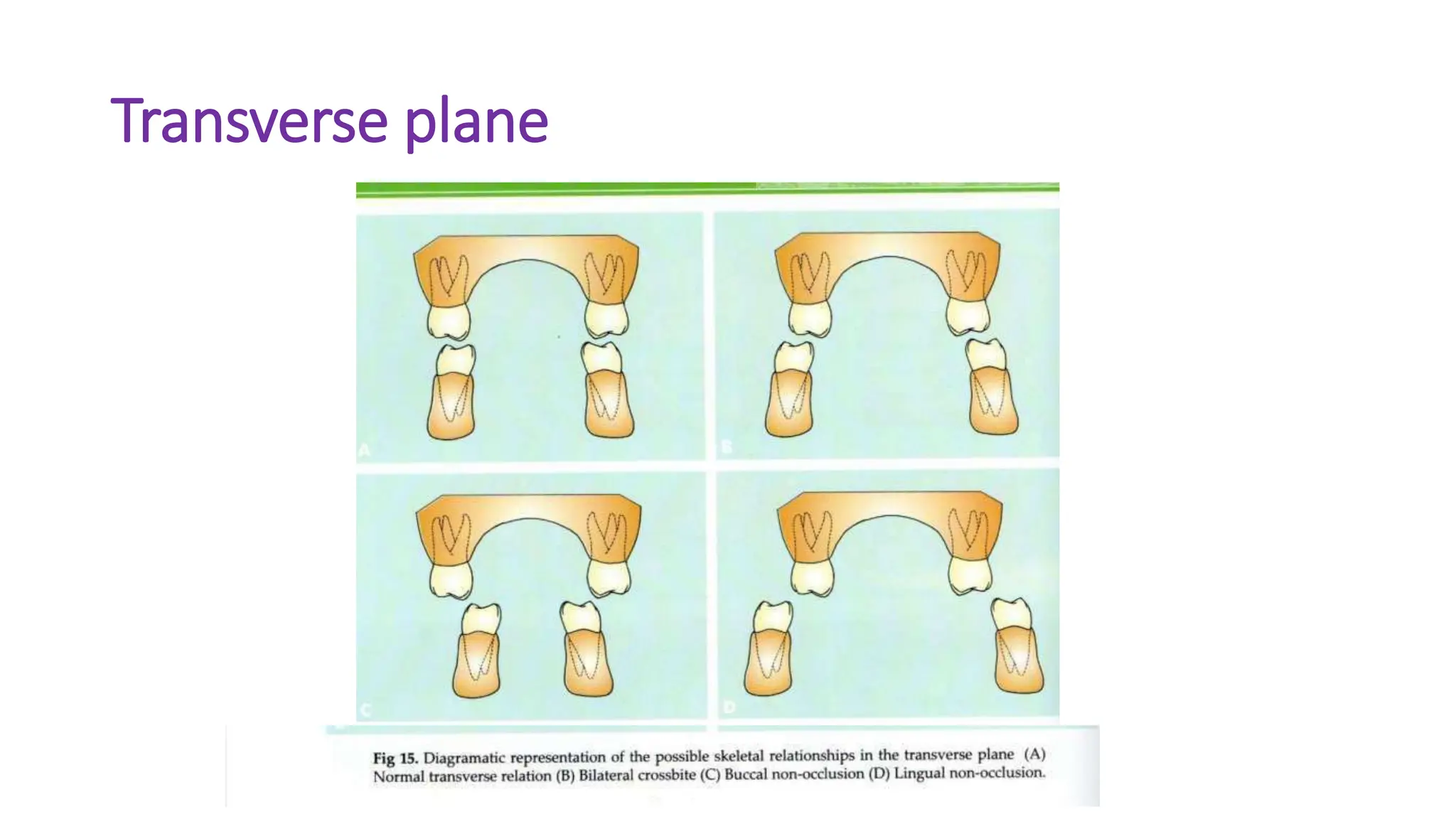Transverse plane
 