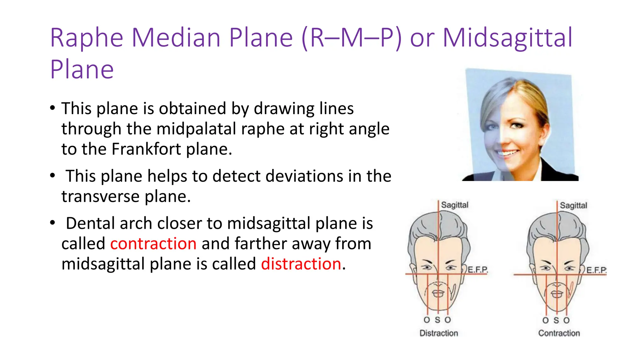 Raphe Median Plane (R–M–P) or Midsagittal
Plane
• This plane is obtained by drawing lines
through the midpalatal raphe at right angle
to the Frankfort plane.
• This plane helps to detect deviations in the
transverse plane.
• Dental arch closer to midsagittal plane is
called contraction and farther away from
midsagittal plane is called distraction.
 