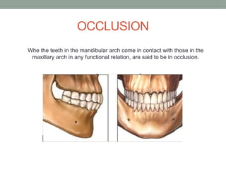 Classification of Maloccvbvvbblusion.pptx