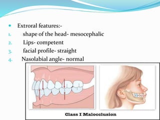  Extroral features:-
1. shape of the head- mesocephalic
2. Lips- competent
3. facial profile- straight
4. Nasolabial angle- normal
 