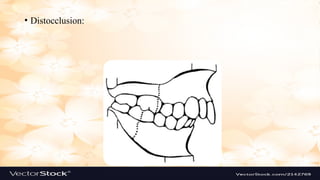 Classification of Malocclusion is a new presentation | PPTX