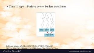Classification of Malocclusion is a new presentation | PPTX