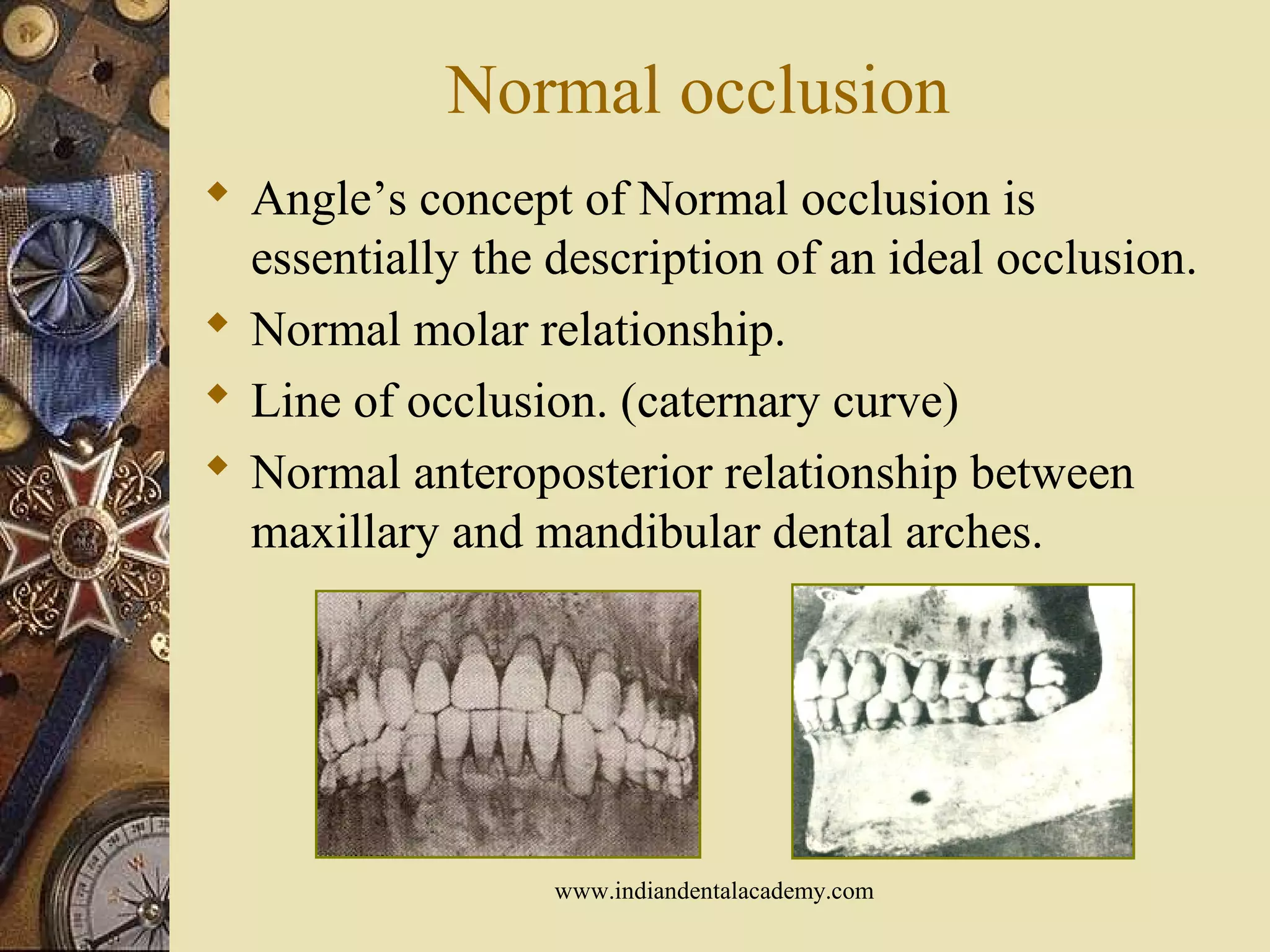 Normal occlusion
 Angle’s concept of Normal occlusion is
essentially the description of an ideal occlusion.
 Normal molar relationship.
 Line of occlusion. (caternary curve)
 Normal anteroposterior relationship between
maxillary and mandibular dental arches.
www.indiandentalacademy.com
 