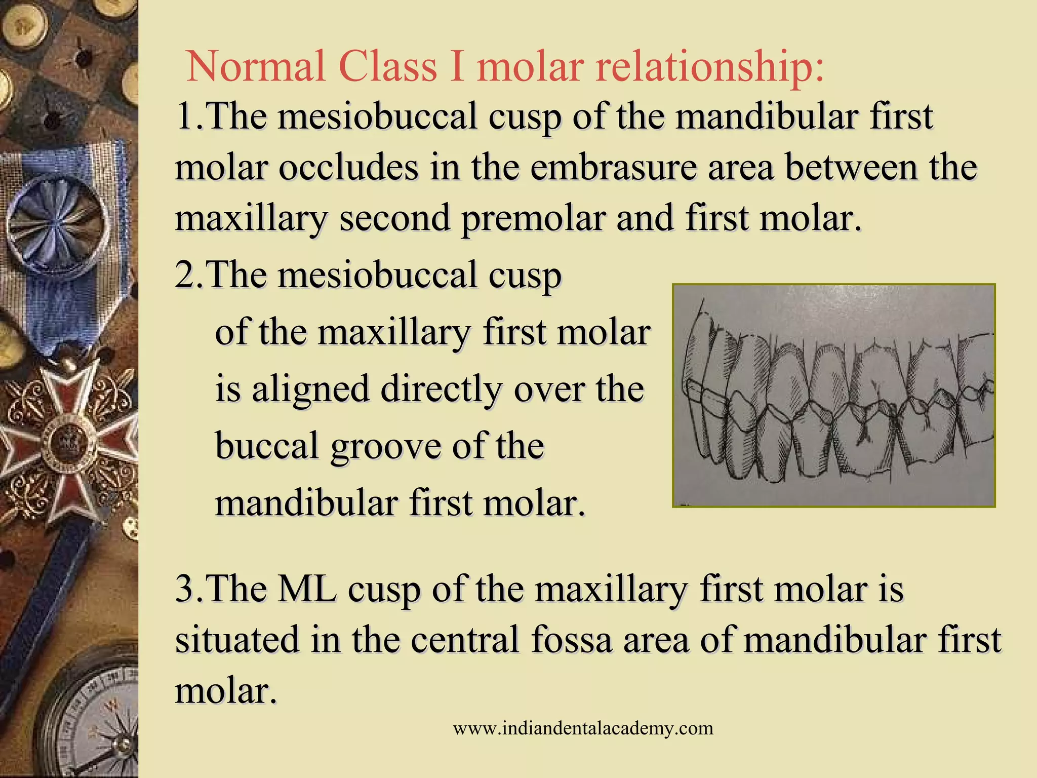 Normal Class I molar relationship:
1.The mesiobuccal cusp of the mandibular first1.The mesiobuccal cusp of the mandibular first
molar occludes in the embrasure area between themolar occludes in the embrasure area between the
maxillary second premolar and first molar.maxillary second premolar and first molar.
2.The mesiobuccal cusp2.The mesiobuccal cusp
of the maxillary first molarof the maxillary first molar
is aligned directly over theis aligned directly over the
buccal groove of thebuccal groove of the
mandibular first molar.mandibular first molar.
3.The ML cusp of the maxillary first molar is3.The ML cusp of the maxillary first molar is
situated in the central fossa area of mandibular firstsituated in the central fossa area of mandibular first
molar.molar.
www.indiandentalacademy.com
 