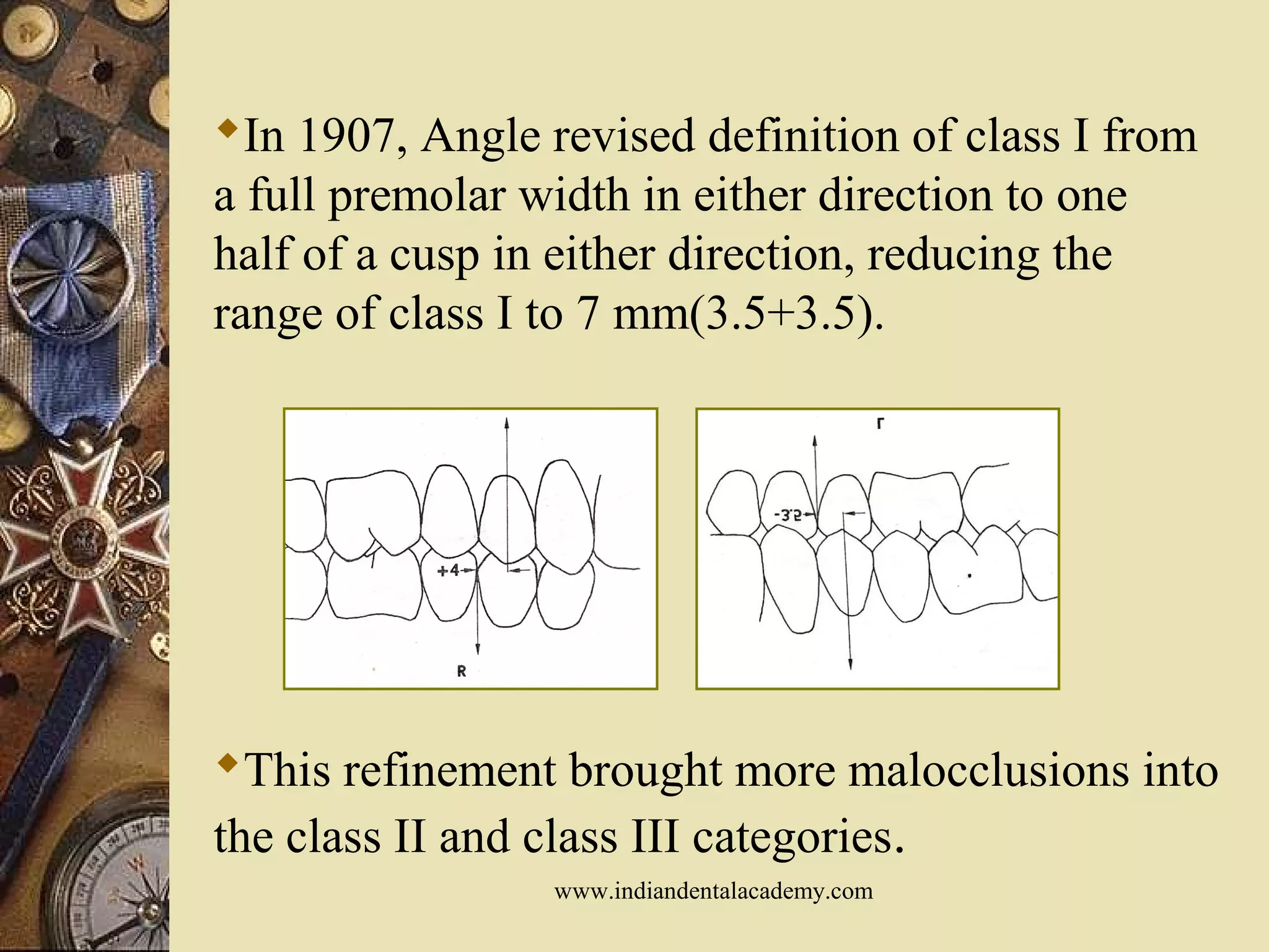 In 1907, Angle revised definition of class I from
a full premolar width in either direction to one
half of a cusp in either direction, reducing the
range of class I to 7 mm(3.5+3.5).
This refinement brought more malocclusions into
the class II and class III categories.
www.indiandentalacademy.com
 